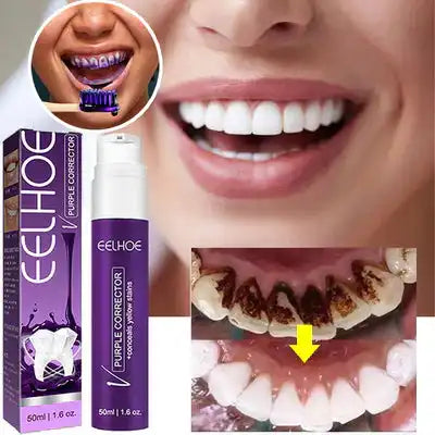 ELHO Teeth Whitening Toothpaste for Removing Yellow Stains - 50 ml