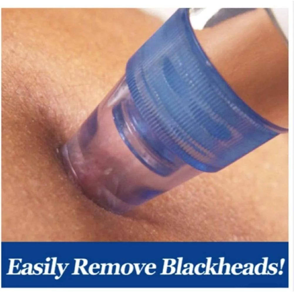 Pore Cleaning Device – Vacuum Blackhead Remover