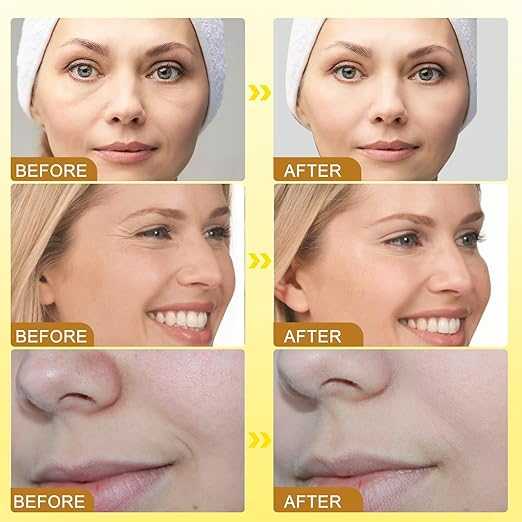 Botox Bee Venom Anti-Wrinkle Face Cream