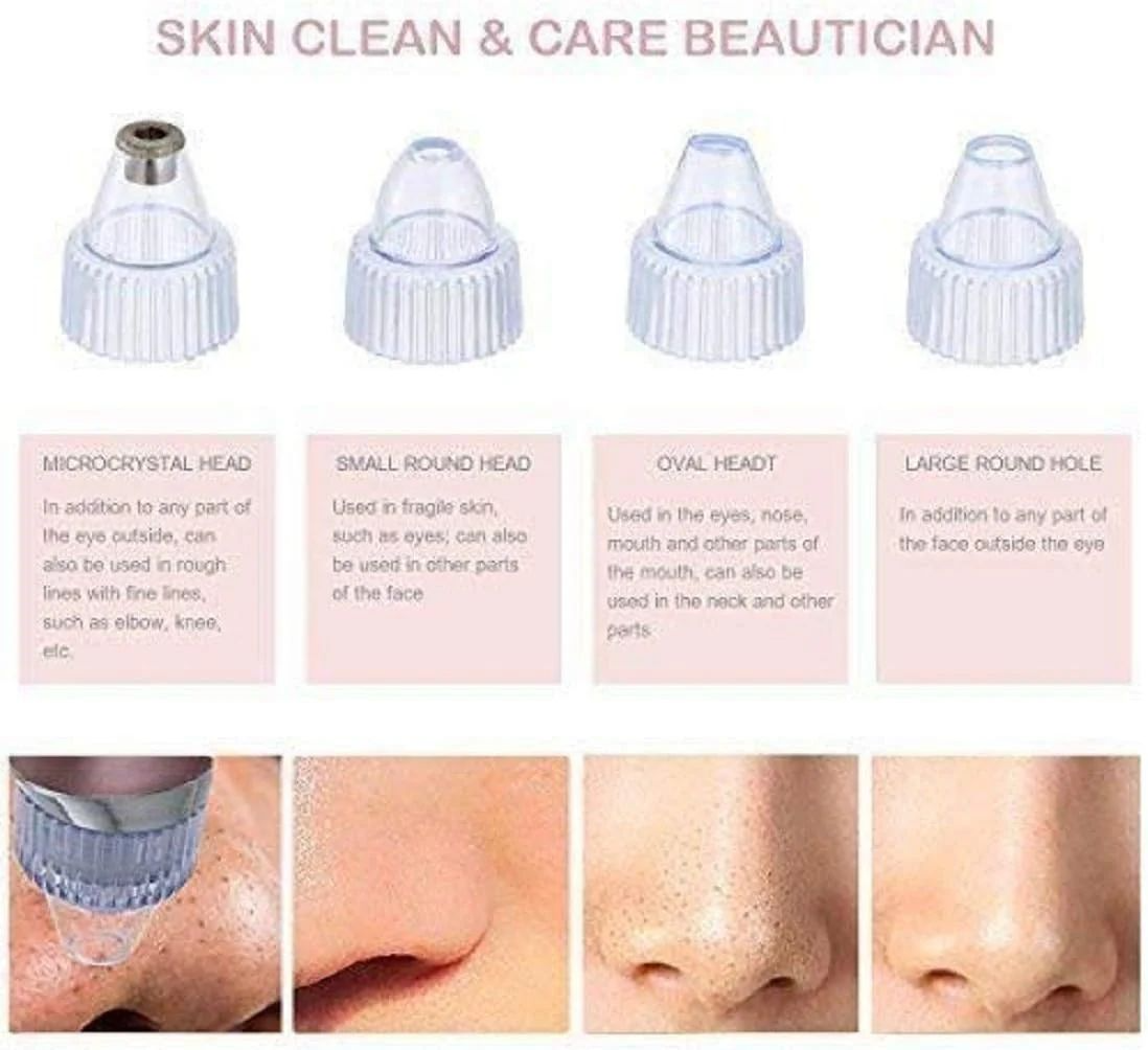 Pore Cleaning Device – Vacuum Blackhead Remover