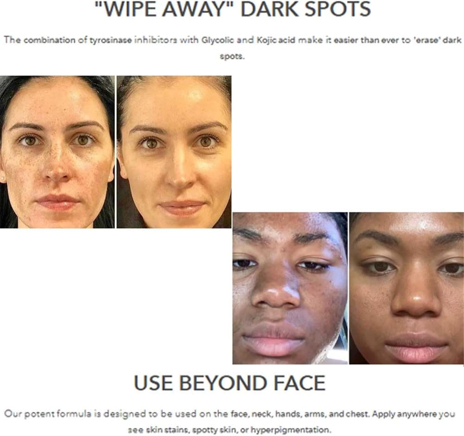 Dark Spot Corrector Brightening Serum for Face & Hands 30ml
