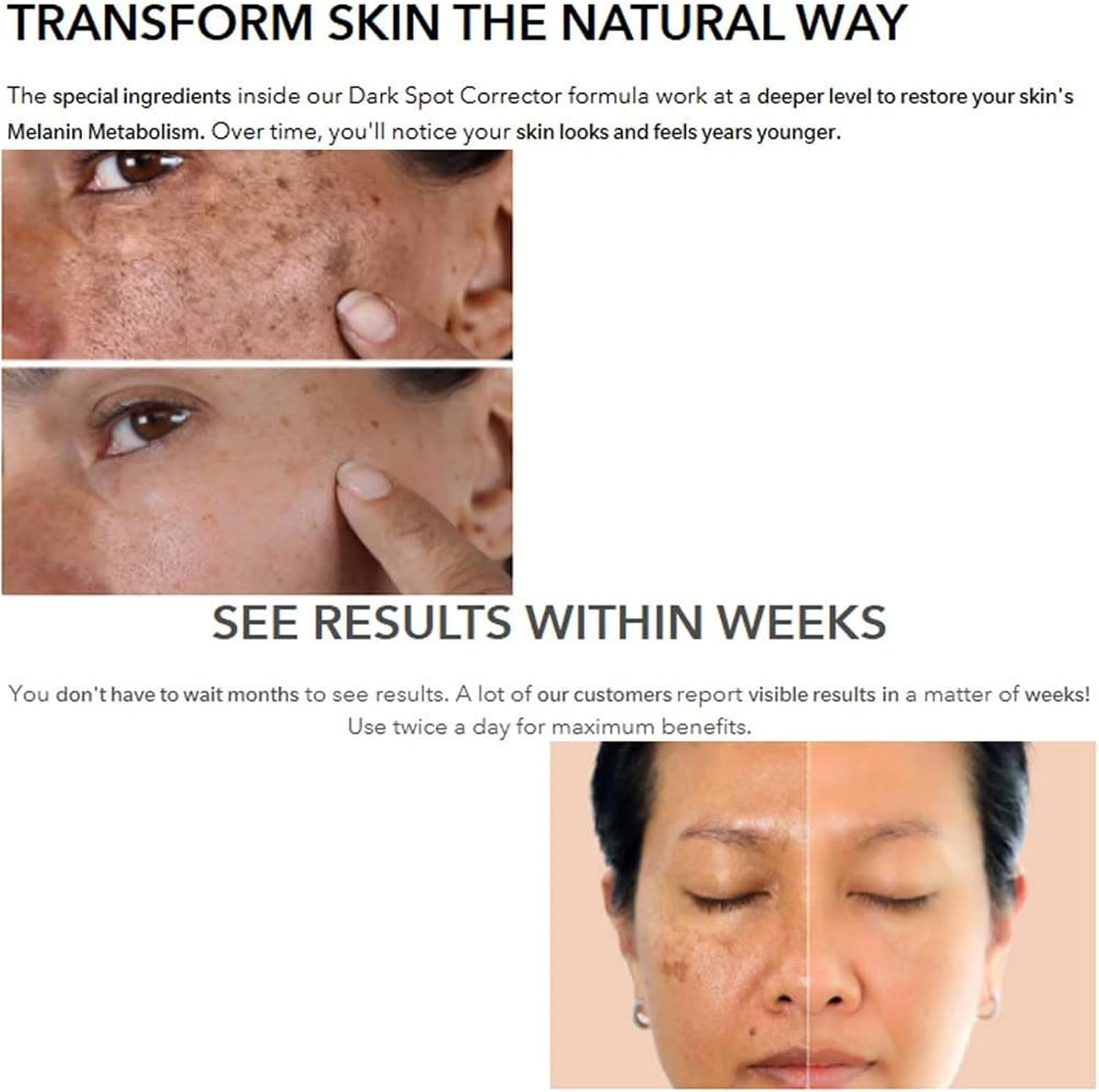 Dark Spot Corrector Brightening Serum for Face & Hands 30ml